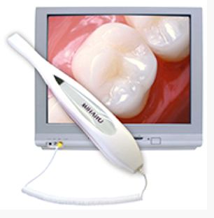 Intraoral cameras are offered by dentist in Ann Arbor, MI.